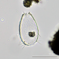 Euglypha compressa