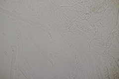 Ciboria amentacea