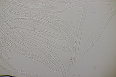 Ciboria amentacea