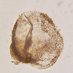 Phaeocystis
