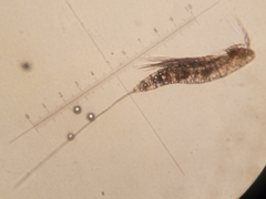 Microsetella