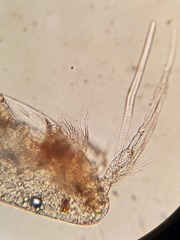 Microsetella