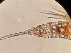 Microsetella