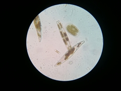 Bacillariophyceae