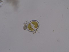 Cocconeis