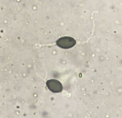 Podospora araneosa