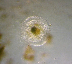 Actinosphaerium