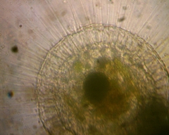Actinosphaerium