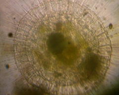 Actinosphaerium