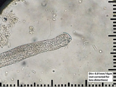 Chaetonotida