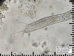 Chaetonotida