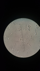 Chrysomphalina chrysophylla