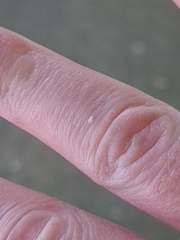 Gasteracantha sanguinea