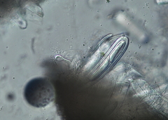 Pertusaria thiospoda