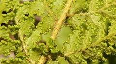Anemia vestita