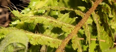 Anemia vestita