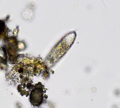 Euglypha bryophila