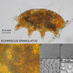 Echiniscus