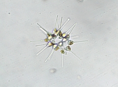 Asterionellopsis