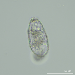 Tracheleuglypha dentata