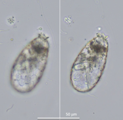 Tracheleuglypha dentata