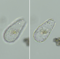 Tracheleuglypha dentata