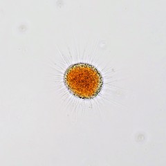 Vampyrella lateritia