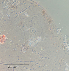 Pulvinaria floccifera