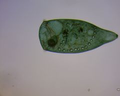Stentor coeruleus