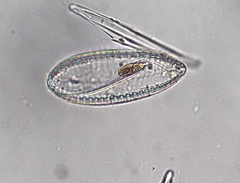 Surirella