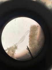 Gastrotricha