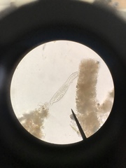 Gastrotricha