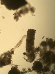 Gastrotricha
