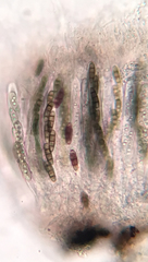 Hysterium angustatum