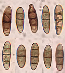 Hysterium angustatum