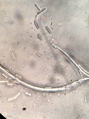 Tolypocladium capitatum