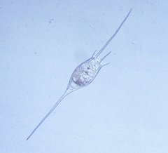 Kellicottia bostoniensis