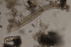 Spirostomum