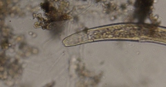 Spirostomum