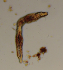 Stenostomum