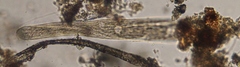 Spirostomum