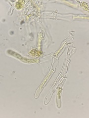 Balsamia