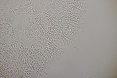 Phomatospora minutissima