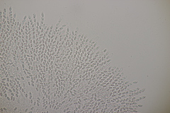 Phomatospora minutissima