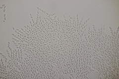 Phomatospora minutissima