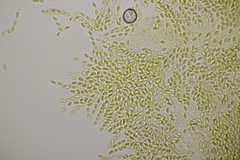 Phomatospora minutissima