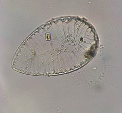 Surirella