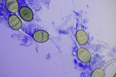 Podospora communis