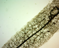 Stemonitis herbatica