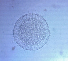 Actinosphaerium